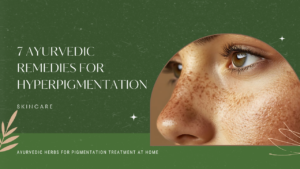 how_to_treat_hyperpigmentation_naturally